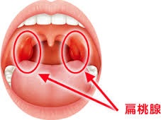 医療用語 扁桃腺