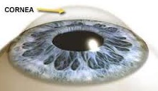 医療用語 角膜炎