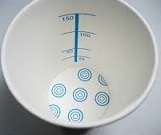 医療用語 検尿 尿検査